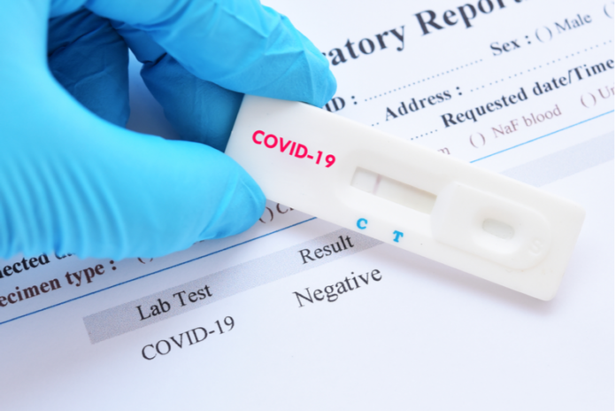 Coronavirus pruebas